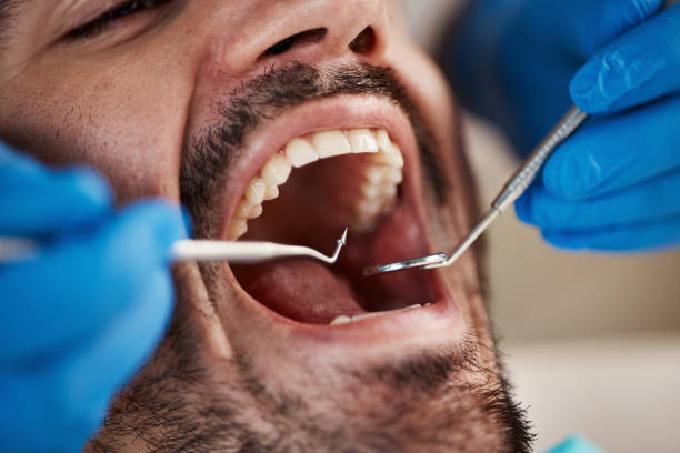 Best Emergency Dental Care for Broken or Chipped Teeth in Lake Bluff, IL